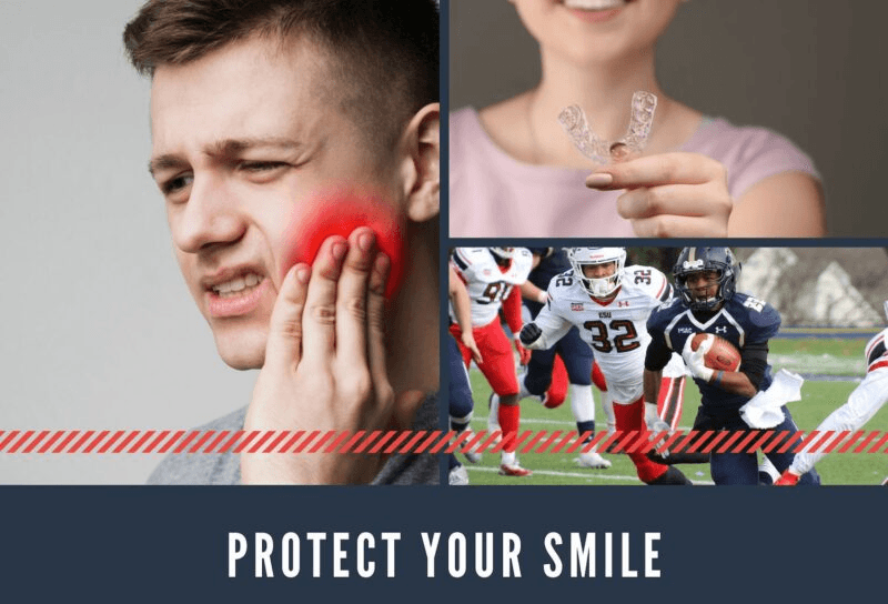 Collage showing jaw pain, mouthguard, and sports athletes - protect your smile