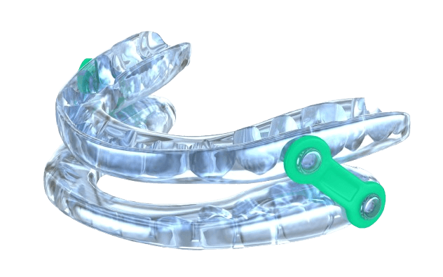Custom mandibular advancement device for snoring prevention at Esthetique Dentistry Ashburn