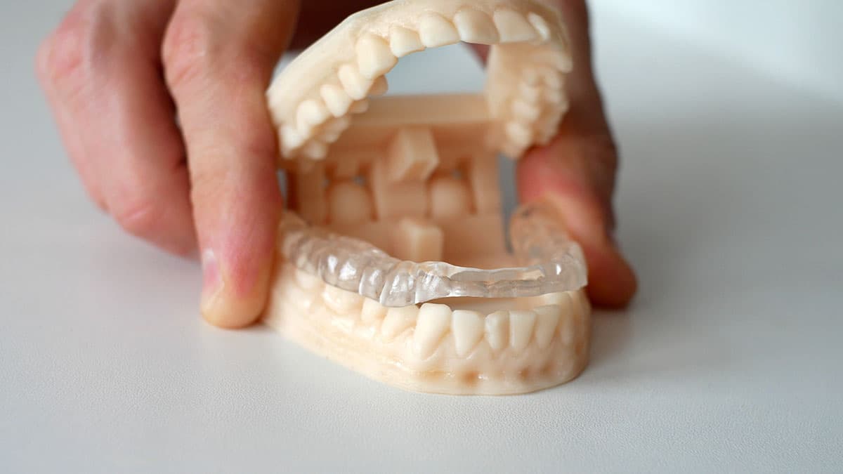 Clear TMJ splint fitted on a dental jaw model, Esthetique Dentistry Ashburn TMJ treatment