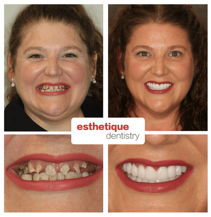 Before and after - Jessica T.